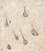 NPY2R Antibody in Immunohistochemistry (Paraffin) (IHC (P))