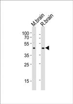 NPY2R Antibody in Western Blot (WB)