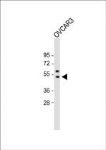 SOX17 Antibody in Western Blot (WB)