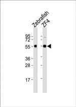 Beclin 1 Antibody in Western Blot (WB)