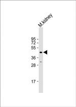 ACP6 Antibody in Western Blot (WB)