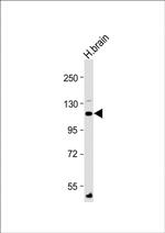 ATP1A4 Antibody in Western Blot (WB)