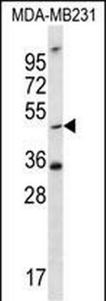 TPST1 Antibody in Western Blot (WB)