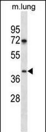 TPST1 Antibody in Western Blot (WB)