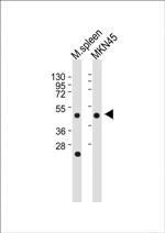 Cathepsin E Antibody in Western Blot (WB)