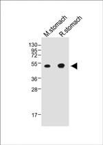 Cathepsin E Antibody in Western Blot (WB)