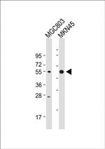 Cathepsin E Antibody in Western Blot (WB)