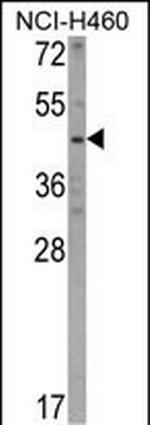 KYNU Antibody in Western Blot (WB)