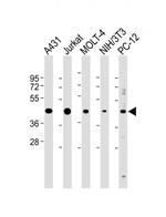 ASS1 Antibody in Western Blot (WB)