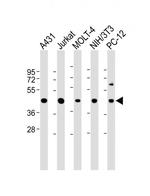 ASS1 Antibody in Western Blot (WB)