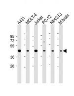 ASS1 Antibody in Western Blot (WB)