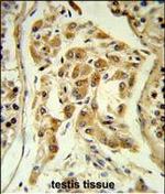 ESPN Antibody in Immunohistochemistry (Paraffin) (IHC (P))