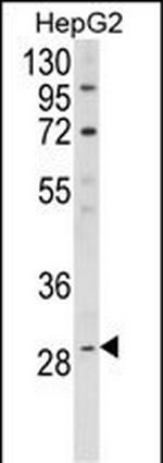 DIO1 Antibody in Western Blot (WB)