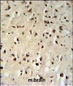 FKBP1B Antibody in Immunohistochemistry (Paraffin) (IHC (P))