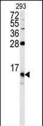 FKBP1B Antibody in Western Blot (WB)