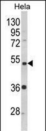 PPP2R2B Antibody in Western Blot (WB)