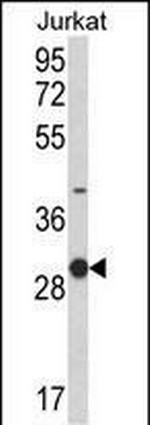 NKG2A Antibody in Western Blot (WB)