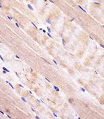 RAB7A Antibody in Immunohistochemistry (Paraffin) (IHC (P))