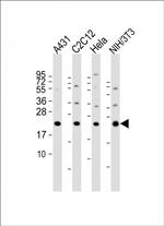 RAB7A Antibody in Western Blot (WB)