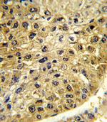 DCT Antibody in Immunohistochemistry (Paraffin) (IHC (P))