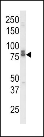 IL18RAP Antibody in Western Blot (WB)