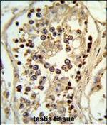 ABHD12 Antibody in Immunohistochemistry (Paraffin) (IHC (P))