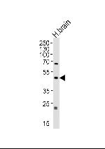 ABHD12 Antibody in Western Blot (WB)