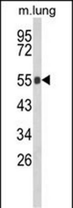 GBA Antibody in Western Blot (WB)