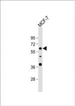 APEX2 Antibody in Western Blot (WB)