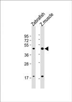 ATF4 Antibody in Western Blot (WB)