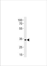 PAX2A Antibody in Western Blot (WB)