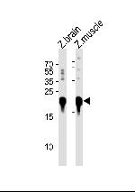 DJ-1 Antibody in Western Blot (WB)