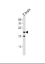 TCF21 Antibody in Western Blot (WB)