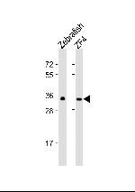 GNB1 Antibody in Western Blot (WB)