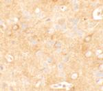 KCNK12 Antibody in Immunohistochemistry (Paraffin) (IHC (P))