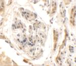 KIAA0701 Antibody in Immunohistochemistry (Paraffin) (IHC (P))