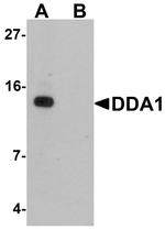 DDA1 Antibody in Western Blot (WB)