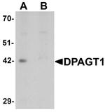 DPAGT1 Antibody in Western Blot (WB)