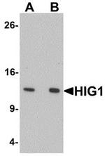 HIGD1A Antibody in Western Blot (WB)