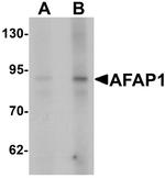 AFAP Antibody in Western Blot (WB)