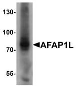 AFAP1L1 Antibody in Western Blot (WB)