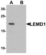 LEMD1 Antibody in Western Blot (WB)