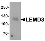 MAN1 Antibody in Western Blot (WB)