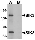 SIK3 Antibody in Western Blot (WB)