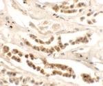 DISP1 Antibody in Immunohistochemistry (Paraffin) (IHC (P))