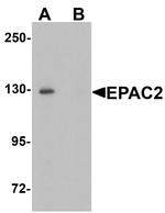 RAPGEF4 Antibody in Western Blot (WB)