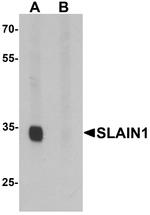 SLAIN1 Antibody in Western Blot (WB)