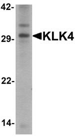 Kallikrein 4 Antibody in Western Blot (WB)