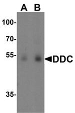 DOPA Decarboxylase Antibody in Western Blot (WB)