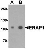 ARTS1 Antibody in Western Blot (WB)